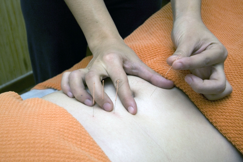 osteopathe-MONS-min_acupuncture-4175625